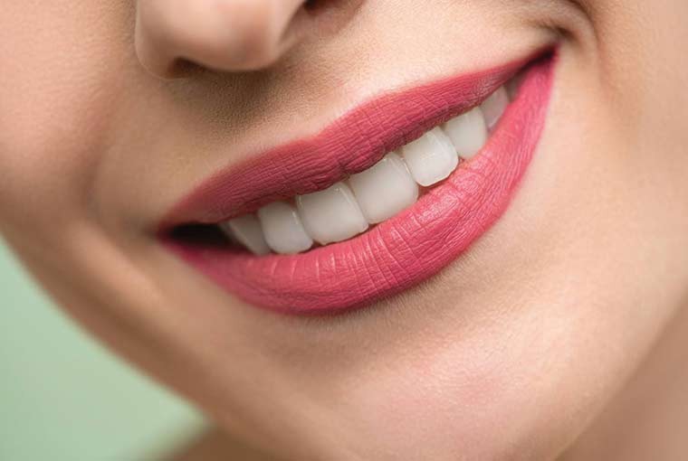 Things to know before getting braces before the wedding