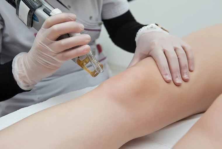 When is the best time of the year to begin your laser hair removal before the wedding?